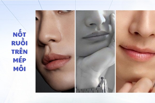 Nốt ruồi ở trên mép môi – Trái phải đều mang điềm xấu