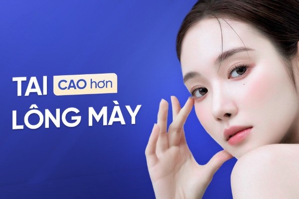 Tai cao hơn lông mày là tốt hay xấu? Dự báo số mệnh ra sao?