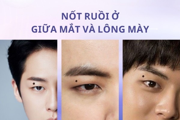 Nốt ruồi ở giữa mắt và lông mày – Vị trí nốt ruồi tài lộc