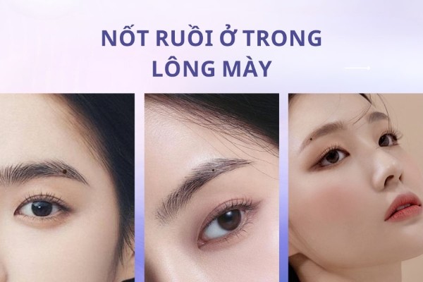 Nốt ruồi ở trong lông mày – Thông điệp tiền bạc và quyền lực
