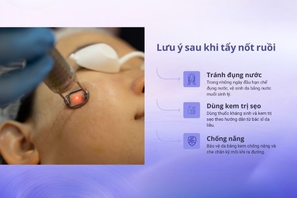 Những điều cần lưu ý sau khi tẩy nốt ruồi tránh thâm và sẹo