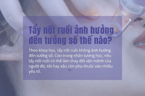 Tẩy nốt ruồi ảnh hưởng như thế nào đến tướng số?