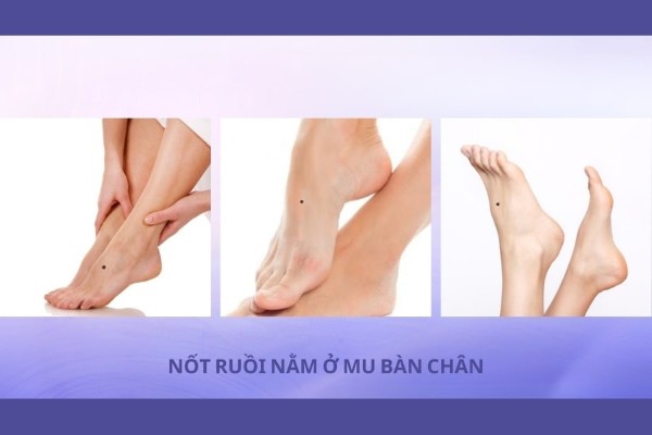 Nốt ruồi nằm ở mu bàn chân – Số lận đận, sống xa quê