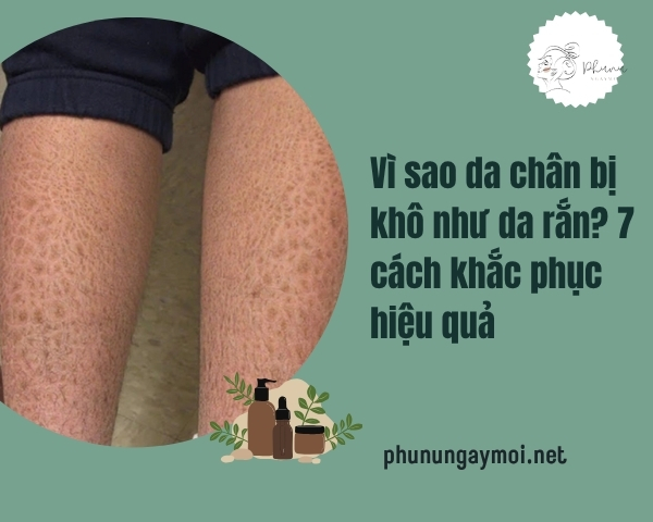 da chân bị khô như da rắn