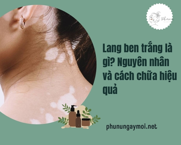 Lang ben trắng