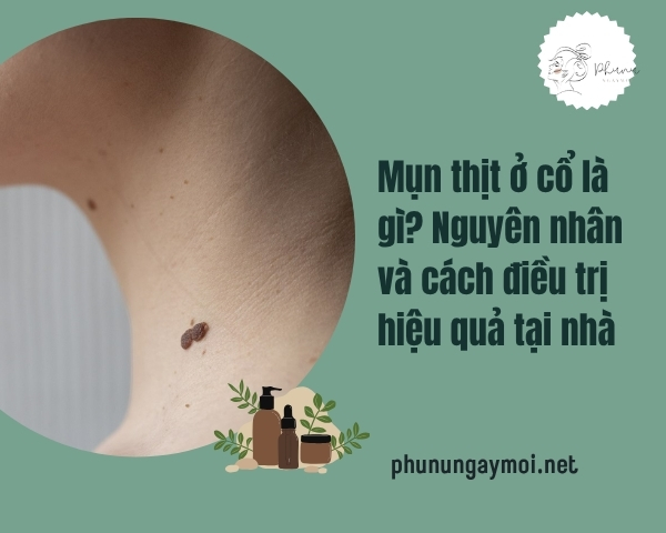 Mụn thịt ở cổ