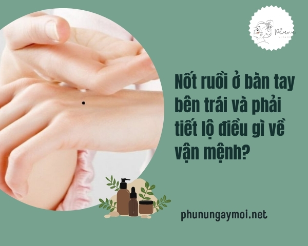 Nốt ruồi ở bàn tay bên trái & phải tiết lộ điều gì?