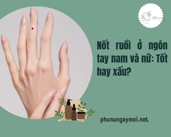Nốt ruồi ở ngón tay
