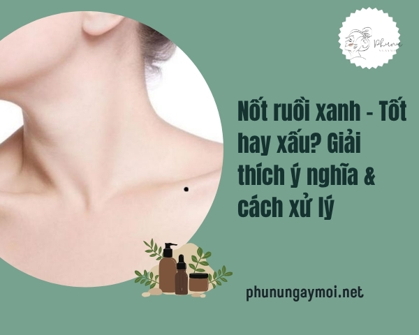 nốt ruồi xanh