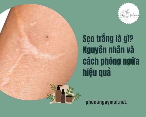 Sẹo trắng là gì? Nguyên nhân và cách phòng ngừa hiệu quả