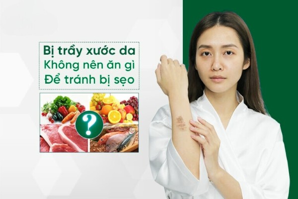 Bị trầy xước da không nên ăn gì để tránh bị sẹo? Theo dõi ngay!