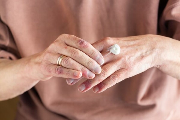 Chăm sóc da da kỹ lưỡng sau khi vết thương lành lại