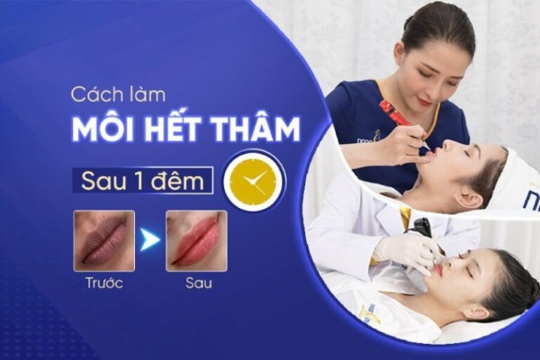 12 Cách làm môi hết thâm sau 1 đêm hiệu quả nhanh chóng 12 Cách làm môi hết thâm sau 1 đêm hiệu quả nhanh chóng