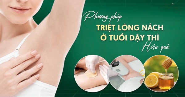 Top 10 Cách triệt lông nách tuổi dậy thì hiệu quả nhất Top 10 Cách triệt lông nách tuổi dậy thì hiệu quả nhất