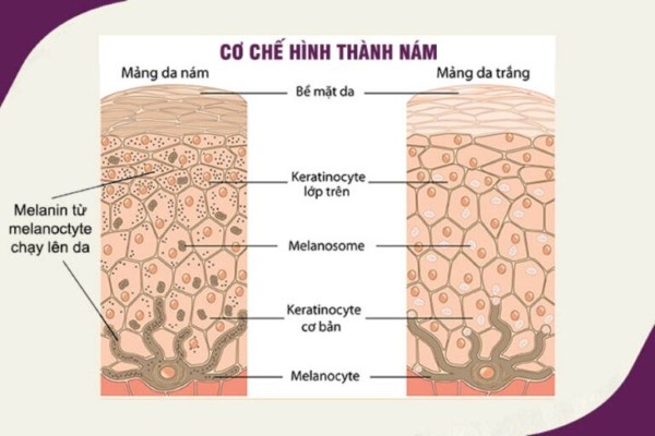 Vận chuyển melanin từ melanocyte lên keratinocyte