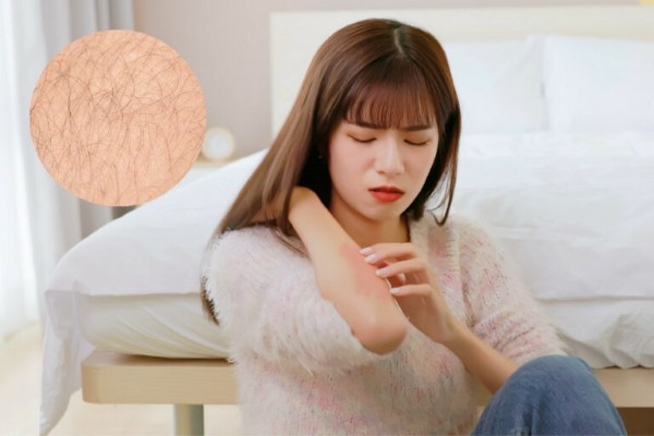 Hội chứng Cushing là một trong những nguyên nhân khiến con gái lông tay nhiều