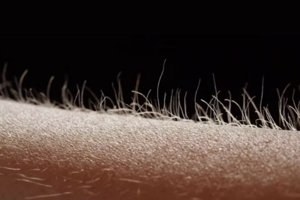 Tình trạng lông ngả vàng hoặc trắng cũng có thể là dấu hiệu cảnh báo một số vấn đề về da liễu