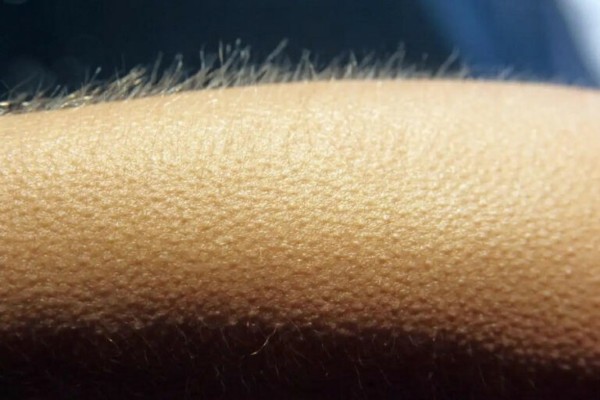 Lông tay dựng đứng là một phản ứng tự nhiên của cơ thể