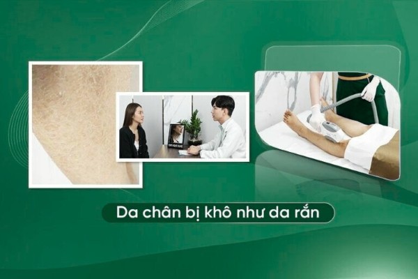 Vì sao da chân bị khô như da rắn? 7 cách khắc phục hiệu quả