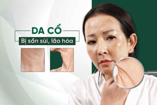 Bật mí cách trẻ hóa da cổ bị sần sùi, lão hóa theo thời gian