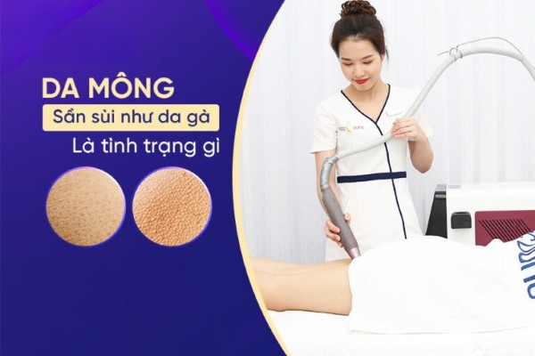 Tại sao da mông sần sùi như da gà? 5 cách giúp mông mịn màng