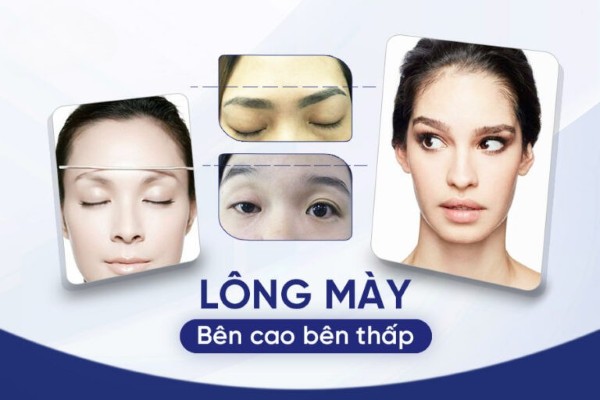 Dáng lông mày bên cao bên thấp không chỉ ảnh hưởng đến thẩm mỹ mà còn mang số mệnh không tốt