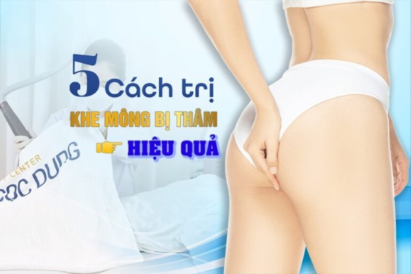 Khe mông bị thâm: Nguyên nhân & 5 cách trị thâm hiệu quả Khe mông bị thâm: Nguyên nhân & 5 cách trị thâm hiệu quả