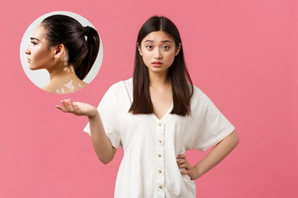 Bệnh lang trắng có thể lây lan thông qua quá trình tiếp xúc ngoài da, hoặc qua việc sử dụng chung đồ vật