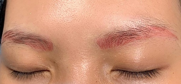 Dấu hiệu nhận biết lông mày trổ đỏ