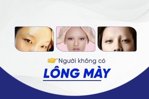 Người không có chân mày phải làm sao? Xem ngay các cách để sở hữu dáng lông mày sắc nét phù hợp với khuôn mặt