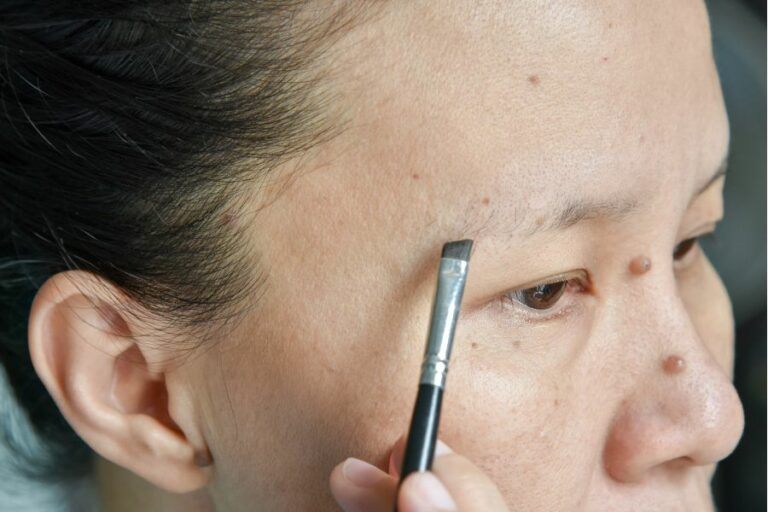 Người không có lông mày da bị viêm da tiết bã