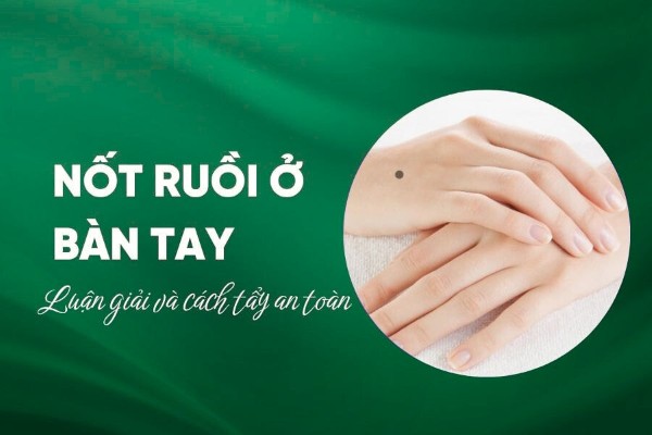 Nốt ruồi ở bàn tay bên trái và phải tiết lộ điều gì về vận mệnh?