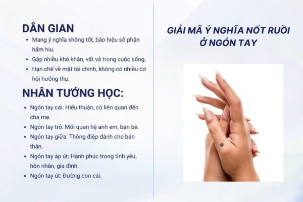 Giải mã ý nghĩa nốt ruồi ở ngón tay