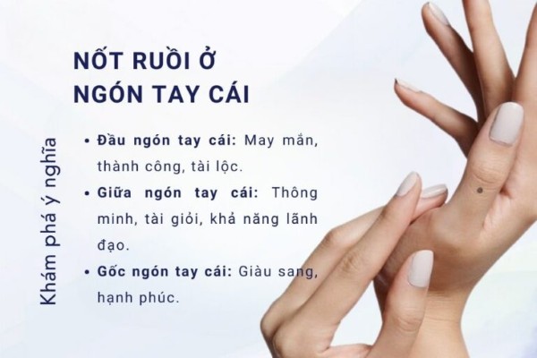 Nốt ruồi ở ngón tay cái – Biểu tượng của tố chất lãnh đạo
