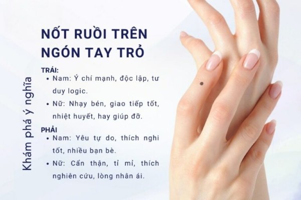 Nốt ruồi ở ngón tay trỏ – Cân nhắc kỹ trong hôn nhân