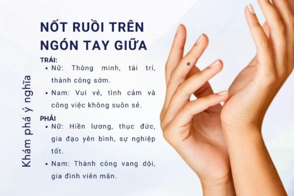 Nốt ruồi ở ngón tay giữa – Cuộc sống thăng trầm, nhiều thay đổi