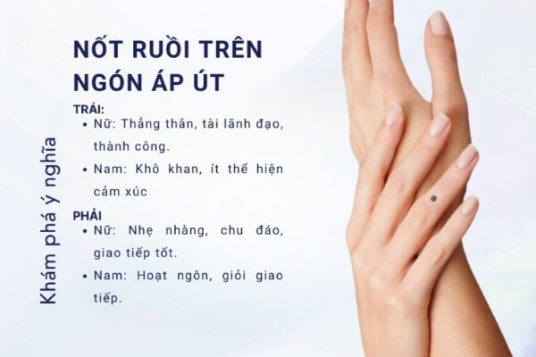 Nốt ruồi ở ngón tay áp út – Dấu hiệu về đường tình duyên