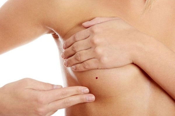 Người sở hữu nốt ruồi ở xung quanh ngực thường có gia đình viên mãn Người sở hữu nốt ruồi ở xung quanh ngực thường có gia đình viên mãn