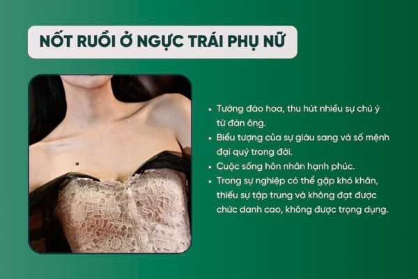 Những nốt ruồi ở trên ngực trái phụ nữ thể hiện sự may mắn trong tình duyên khi luôn có nhiều người theo đuổi và để ý Những nốt ruồi ở trên ngực trái phụ nữ thể hiện sự may mắn trong tình duyên khi luôn có nhiều người theo đuổi và để ý