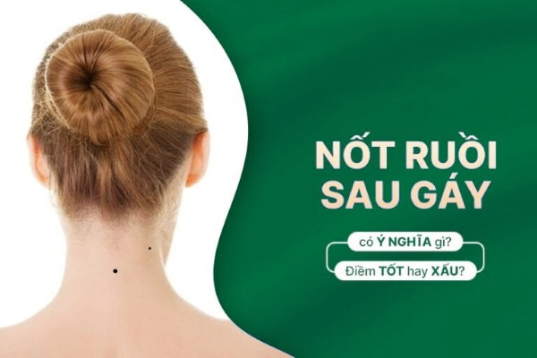 Nốt ruồi sau gáy ở nam và nữ nói lên điều gì? Phước hay họa? Nốt ruồi sau gáy ở nam và nữ nói lên điều gì? Phước hay họa?