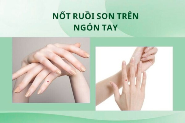 Xem tướng mụn ruồi son trên các ngón tay nam nữ Xem tướng mụn ruồi son trên các ngón tay nam nữ