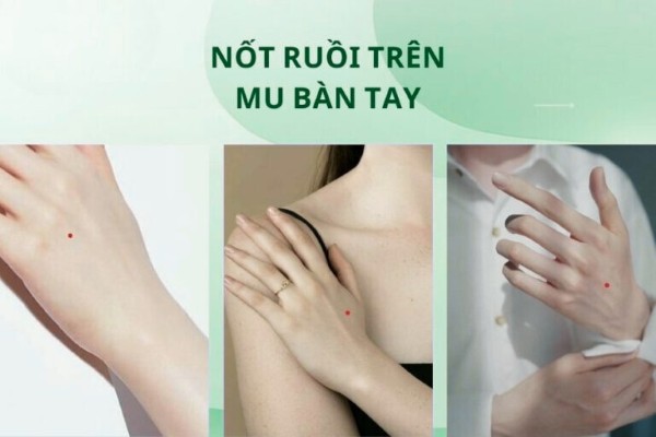 Mụn ruồi son là nốt ruồi như thế nào trong nhân tướng học? Mụn ruồi son là nốt ruồi như thế nào trong nhân tướng học?