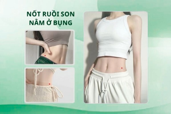 Nốt ruồi son ở bụng – Nữ có tài lãnh đạo, nam nhiều tham vọng Nốt ruồi son ở bụng – Nữ có tài lãnh đạo, nam nhiều tham vọng