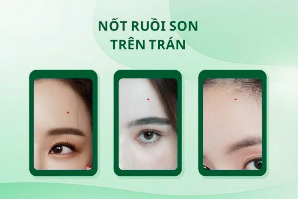 Nốt ruồi son ở trán – Dấu hiệu của trí tuệ và khả năng thích nghi Nốt ruồi son ở trán – Dấu hiệu của trí tuệ và khả năng thích nghi