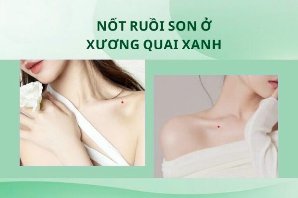Nốt ruồi son ở xương quai xanh – Được quý nhân nâng đỡ, tình duyên và sự nghiệp thuận lợi Nốt ruồi son ở xương quai xanh – Được quý nhân nâng đỡ, tình duyên và sự nghiệp thuận lợi