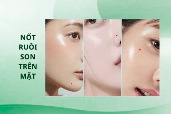 Nốt ruồi son trên mặt – Dấu hiệu của phú quý và thăng tiến Nốt ruồi son trên mặt – Dấu hiệu của phú quý và thăng tiến
