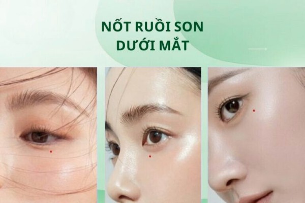 Nốt ruồi son ở đâu thì tốt nhất cho nam và nữ? Nốt ruồi son ở đâu thì tốt nhất cho nam và nữ?