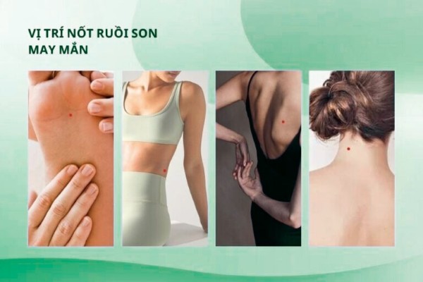 Những vị trí nốt ruồi đỏ sẽ mang lại may mắn cho người sở hữu Những vị trí nốt ruồi đỏ sẽ mang lại may mắn cho người sở hữu