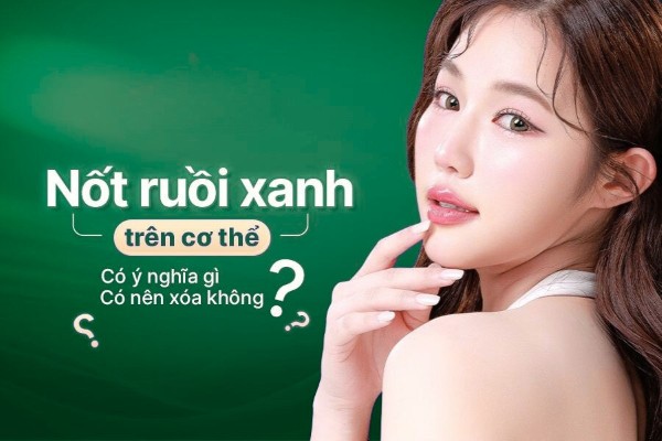 Nốt ruồi xanh – Tốt hay xấu? Giải thích ý nghĩa & cách xử lý
