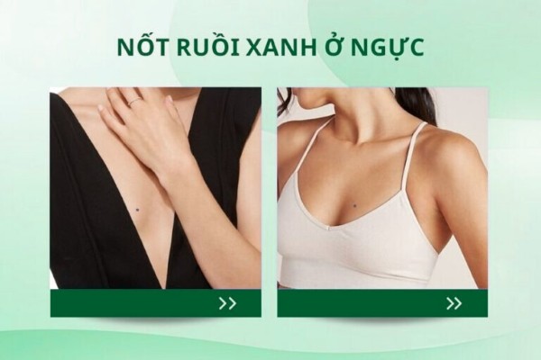 Nốt ruồi xanh ở ngực – Tình duyên lận đận, dễ tổn thương